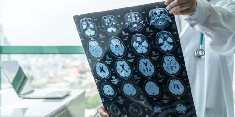 أمريكي يرى وجوه الآخرين مشوهة ,,, أغرب اضطراب عصبي