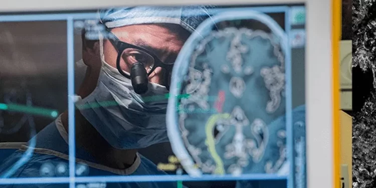 باحثون ينجحون في تقليص حجم أورام الدماغ بالخلايا التائية