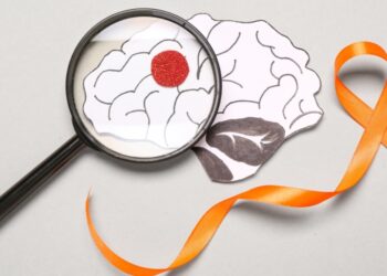 مسببات وأعراض مرض التصلب المتعدد