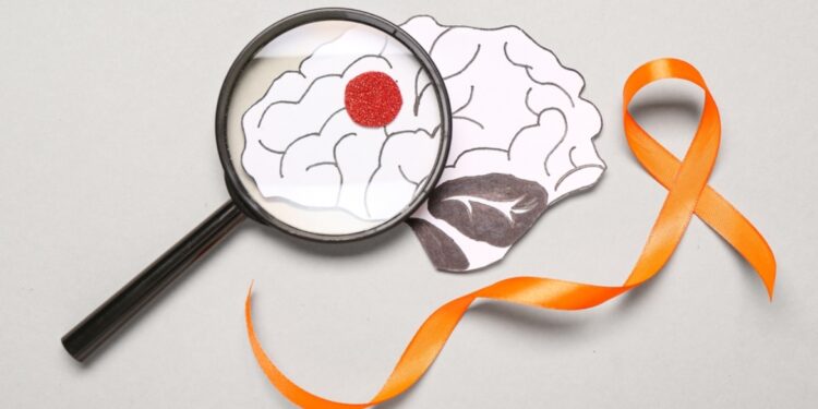 مسببات وأعراض مرض التصلب المتعدد