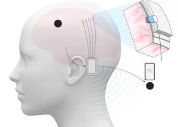 ماسك يعلن نجاح زرع شريحة دماغية لشخص ثالث