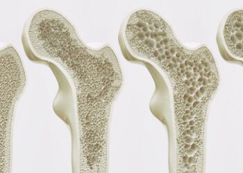 كيف تحافظ على قوة عظامك؟