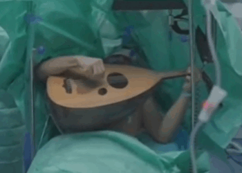 العراق.. مطرب يعزف على العود أثناء استئصال ورم دماغي ,,, مشهد استثنائي