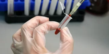تركيبة دوائية جديدة ربما تنجـــح في عـــــلاج “اللوكيميا الحادة”
