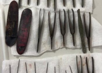في عملية جراحية نادرة.. فريق طبي في السليمانية يستخرج 16 ملقطاً و8 إبر وغلافين من معدة مواطن