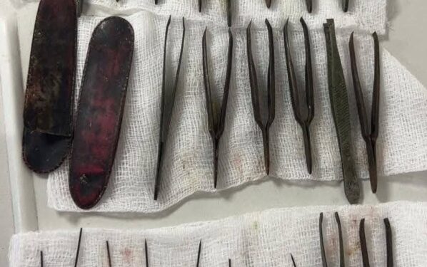 في عملية جراحية نادرة.. فريق طبي في السليمانية يستخرج 16 ملقطاً و8 إبر وغلافين من معدة مواطن