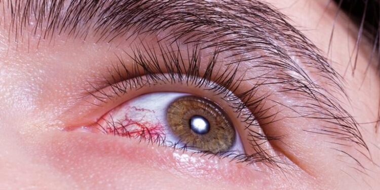 7 خطوات يومية تحمي العينين