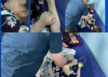 حادثة تهز النجف.. اعتقال متهمات بالاعتداء الجسدي الوحشي على طفلة